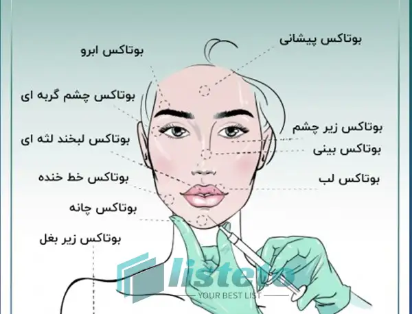 بازار کار تزریق ژل و بوتاکس در شهرضا